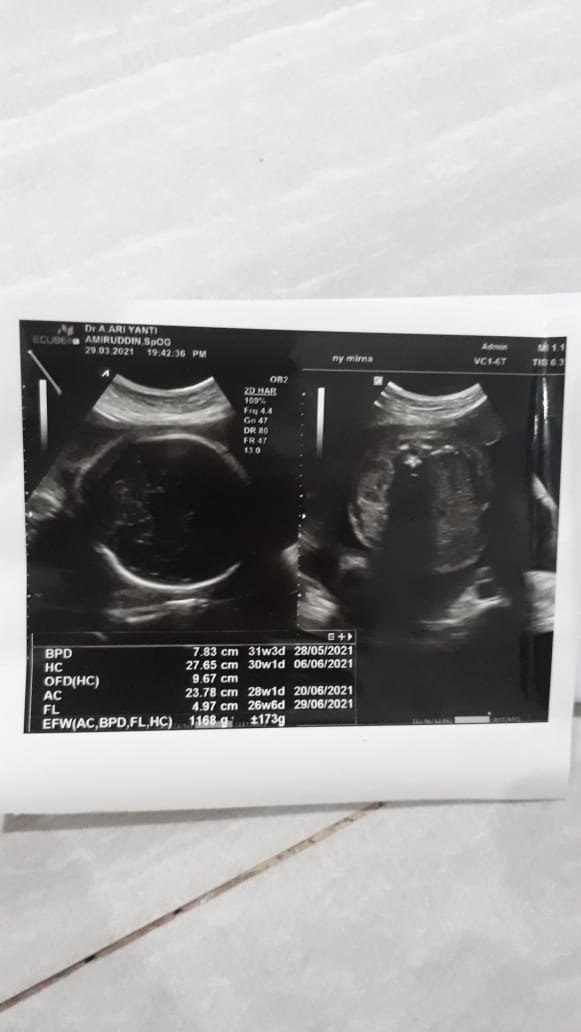 Kunjungan Kedua Ibu Mirna
